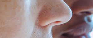 Rhinoplasty San Diego